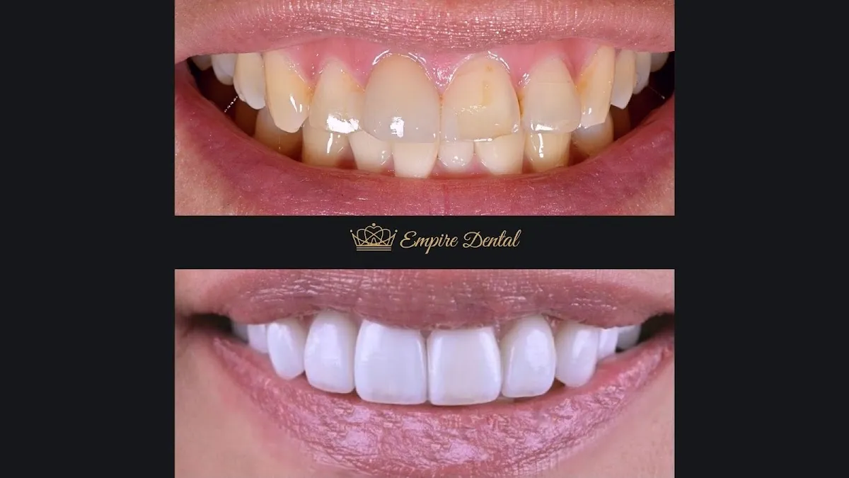 Empire Dental